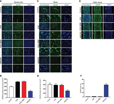 Corrigendum: Low Frequency Ultrasound With Injection of NMO-IgG and Complement Produces Lesions Different From Experimental Autoimmune Encephalomyelitis Mice